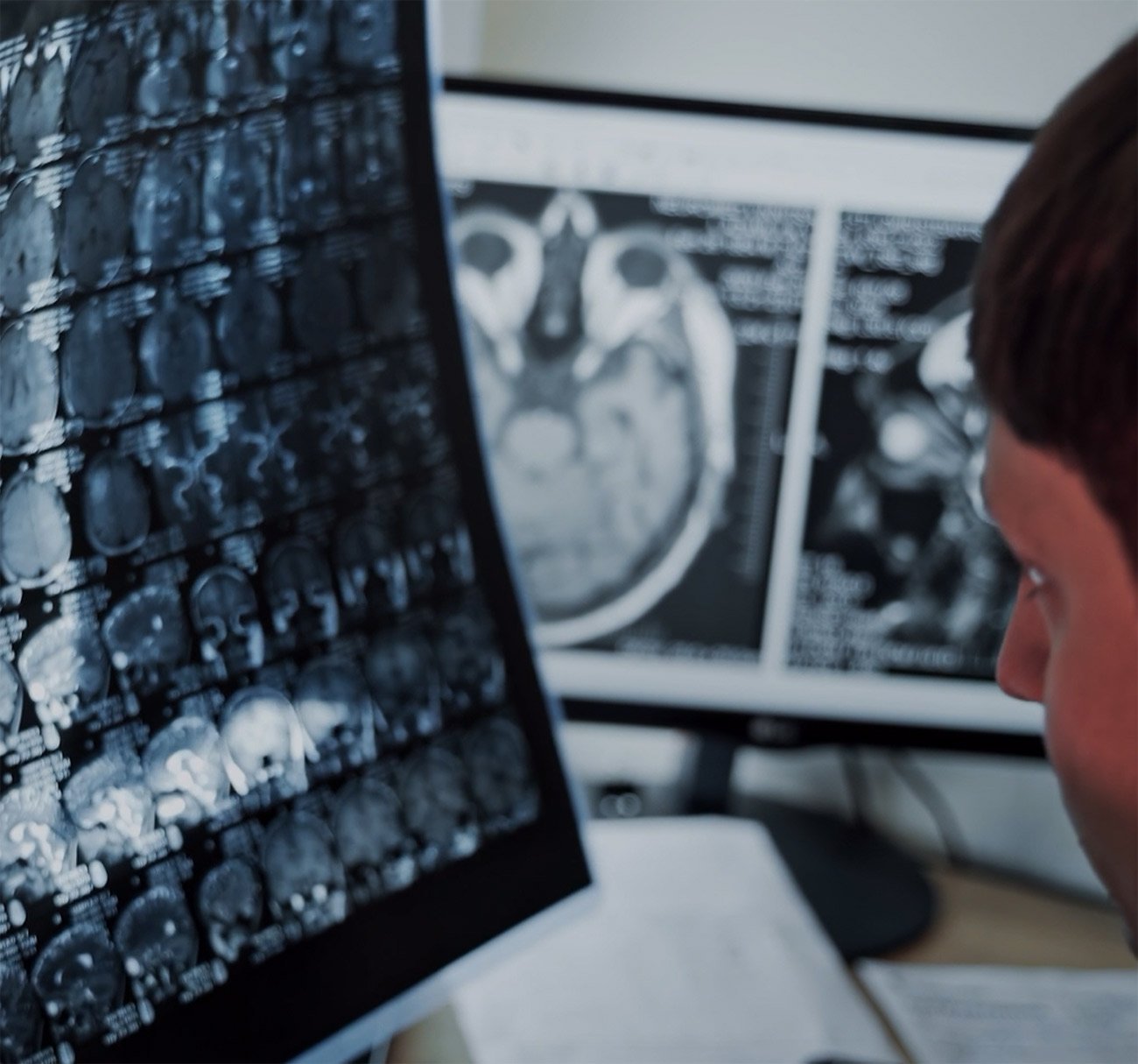 Radiologie Machen Sie sich ein Bild